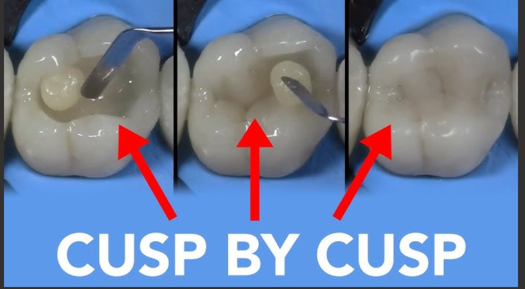 molars